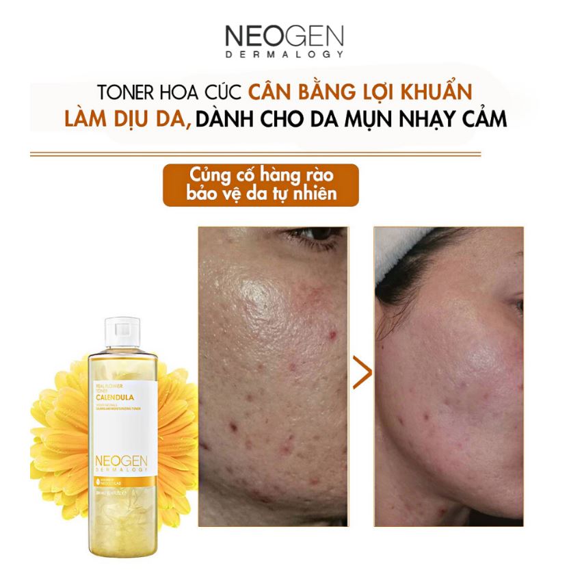 Nước Hoa Hồng Chiết Xuất Hoa Cúc Siêu Cấp Ẩm Dịu Da Cho Da Mụn Neogen Dermalogy Real Flower Calendula Toner