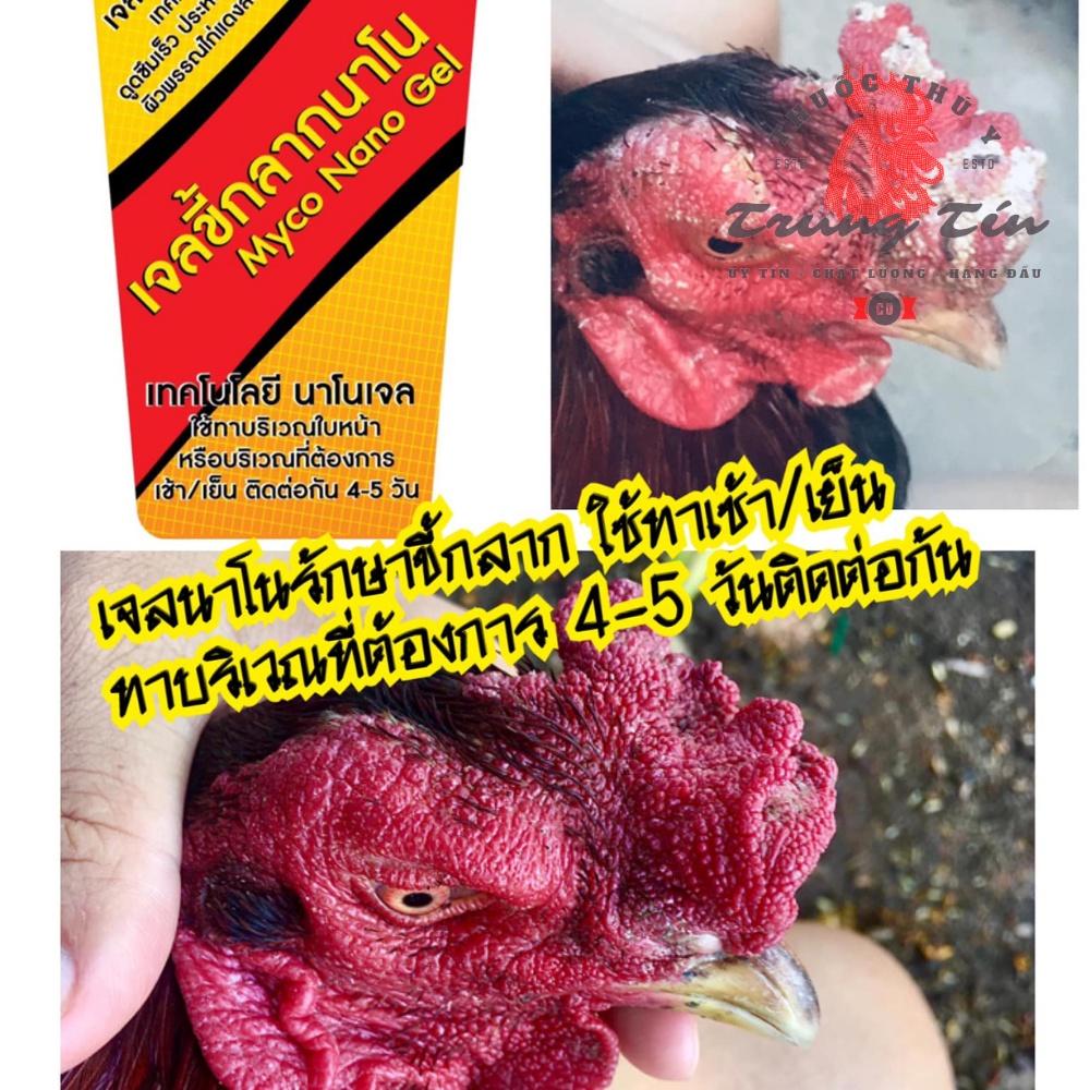 Đặc tr.ị lác nấm mốc dạng típ bôi , siêu hiệu quả