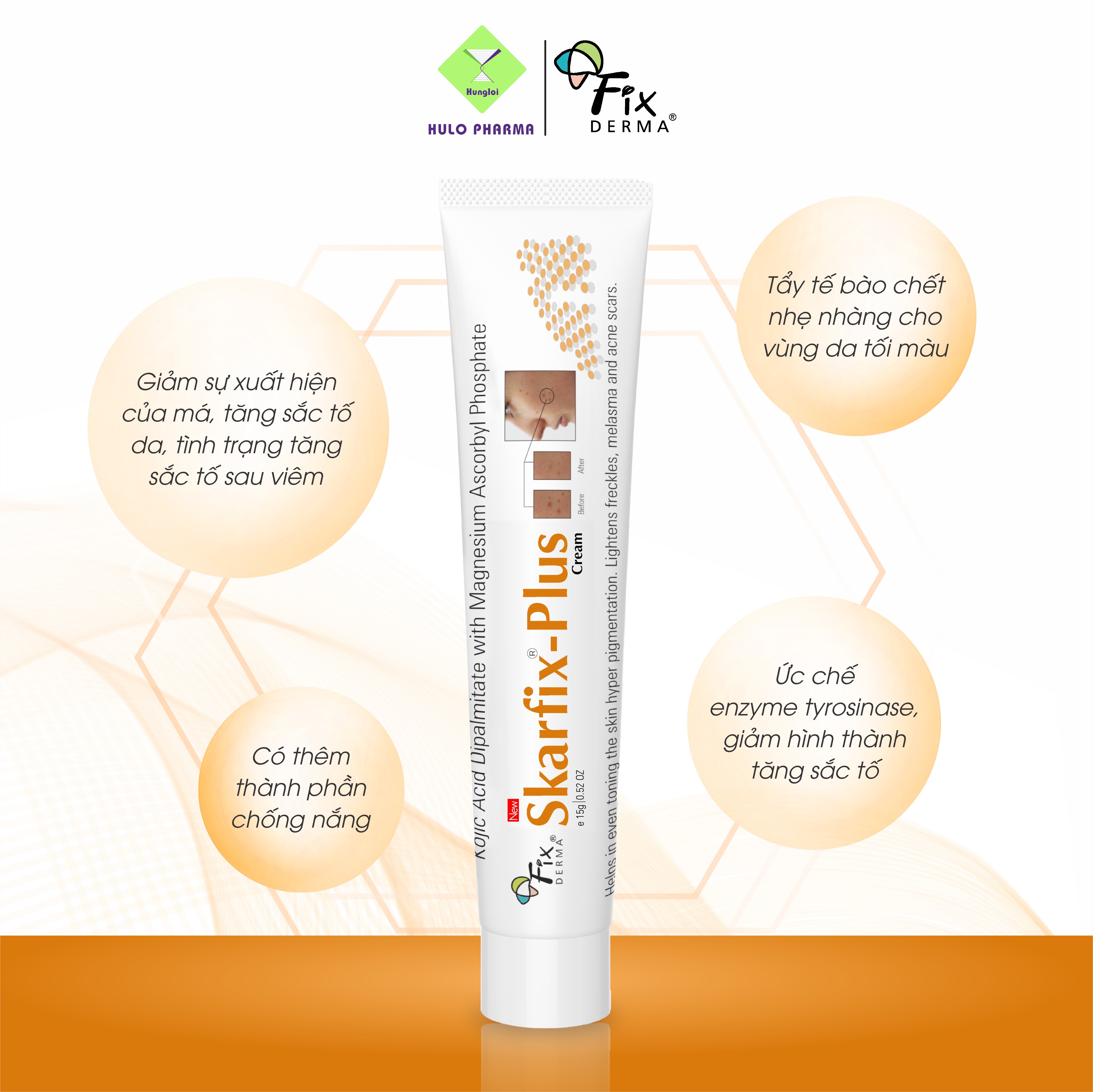 Kem sáng da Fixderma Skarfix Plus Cream (15g)