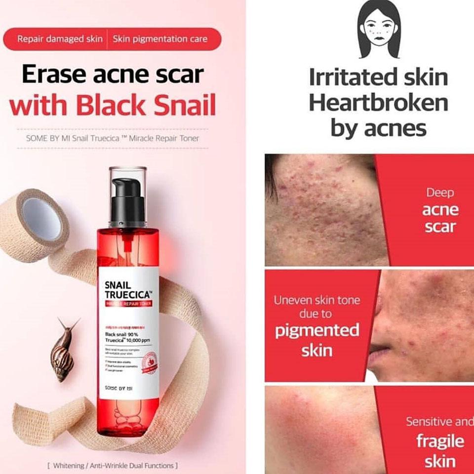 Bộ 3 Sản Phẩm Dưỡng Da, Cải Thiện Sẹo Lõm Some By Mi Snail Truecica Miracle Repair Gồm Toner Snail 135ml + Serum Snail 50ml + Kem dưỡng Snail 60g