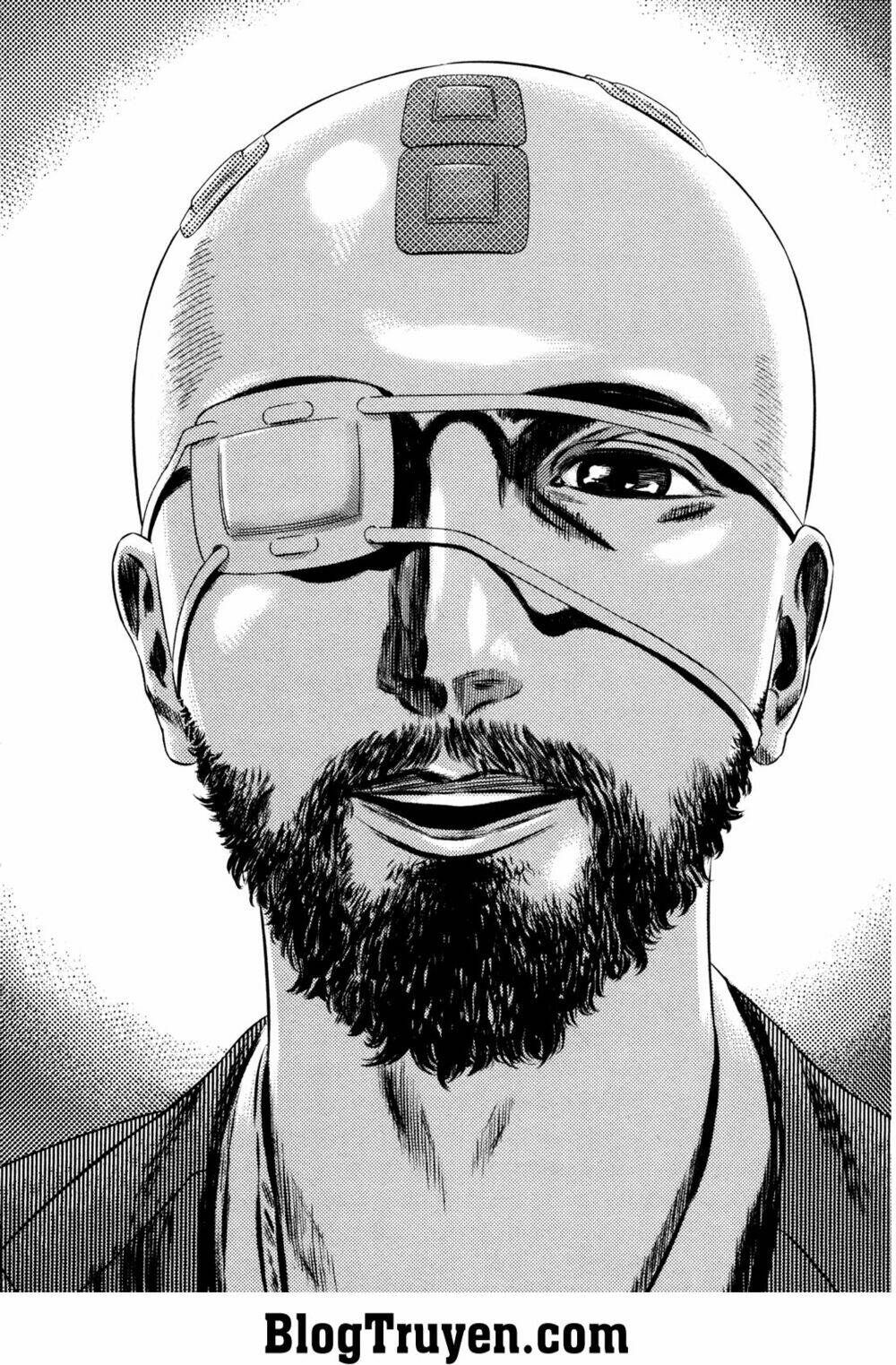 homunculus chapter 158 14