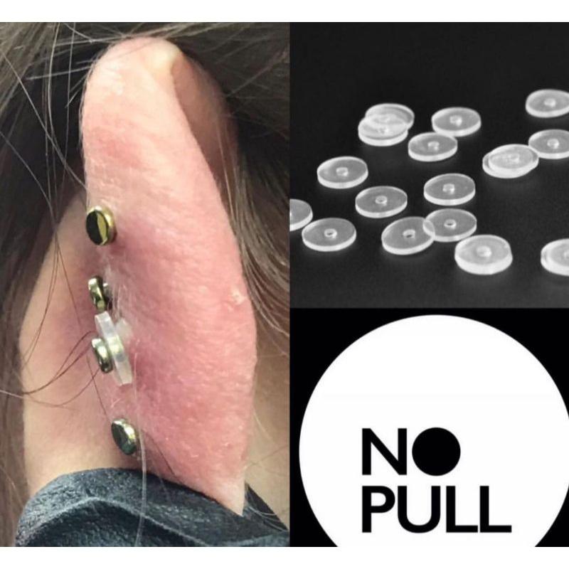 MIẾNG Nopull Disc / Miếng Nẹp Bump - Nẹp bump / Đệm siết