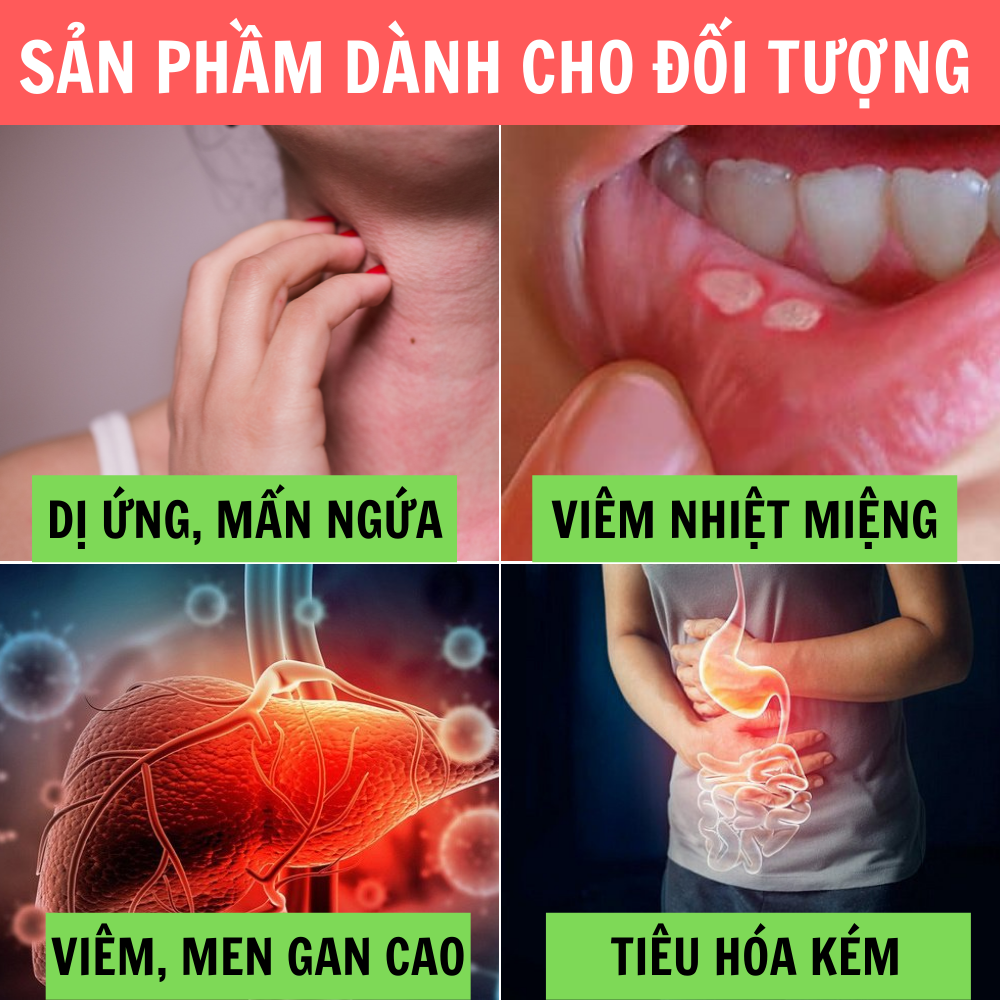 DETOXIFY - Giúp thanh nhiệt, tiêu độc, mát gan, Hỗ trợ làm giảm các triệu chứng : dị ứng, mẩn ngứa, nổi mề đay,mụn nhọt, rôm sảy, nhiệt miệng, nhiệt lưỡi