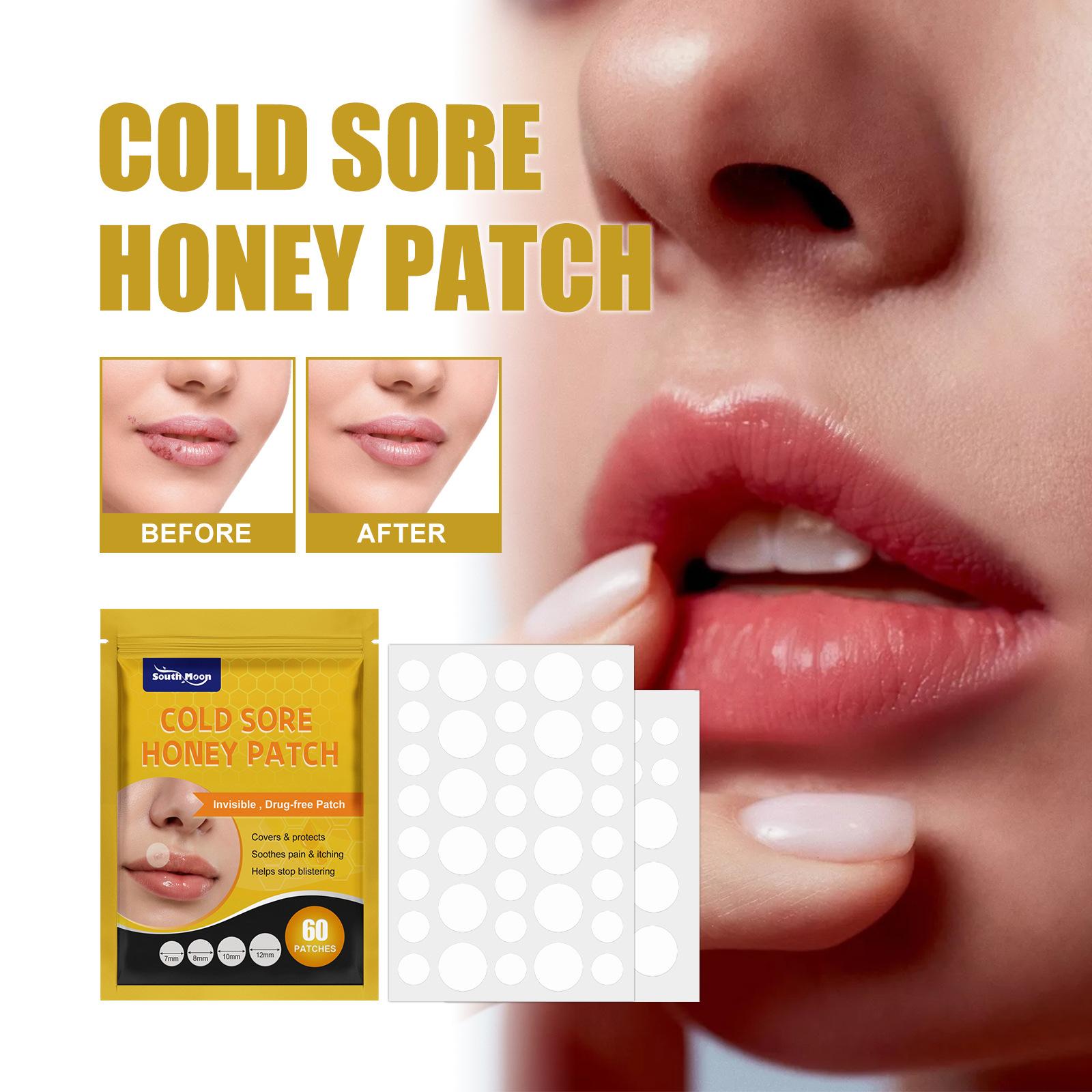 South Moon 60 patches Cold Sore Honey Patch Blister Treatment Conceals Protects Soothes & Hides Cold Sores