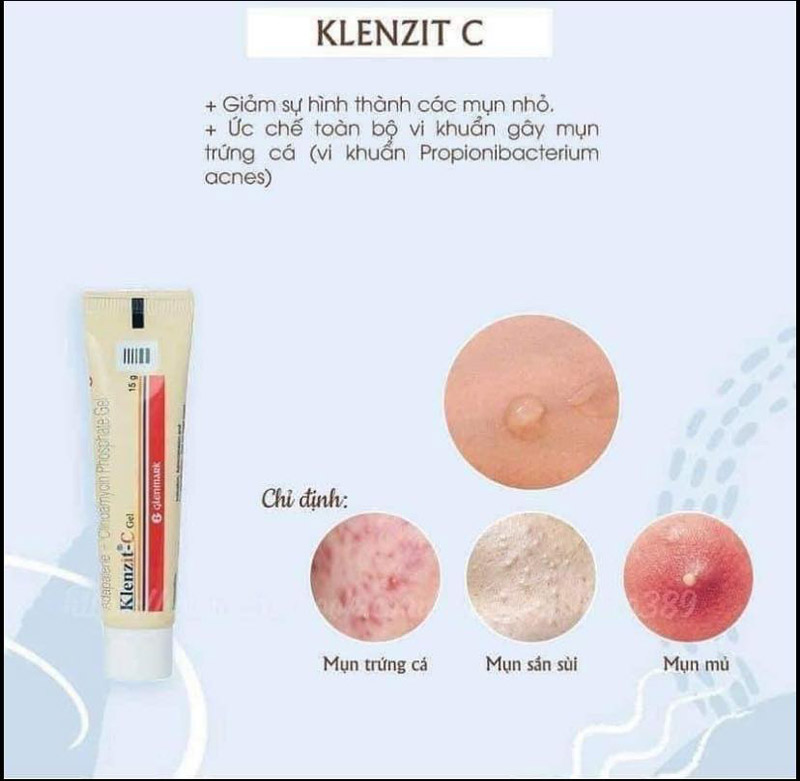 Kem klenzit c giảm mụn Viêm, mụn ẩn tuýp 15g