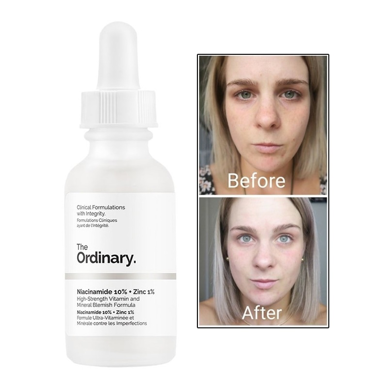 Tinh chất giảm mụn và vết thâm, se khít lỗ chân lông, trắng sáng da The Ordinary Niacinamide 10% + Zinc 1% (30ml) + Tặng 1 mặt nạ sủi bọt Su:m 37 Đen