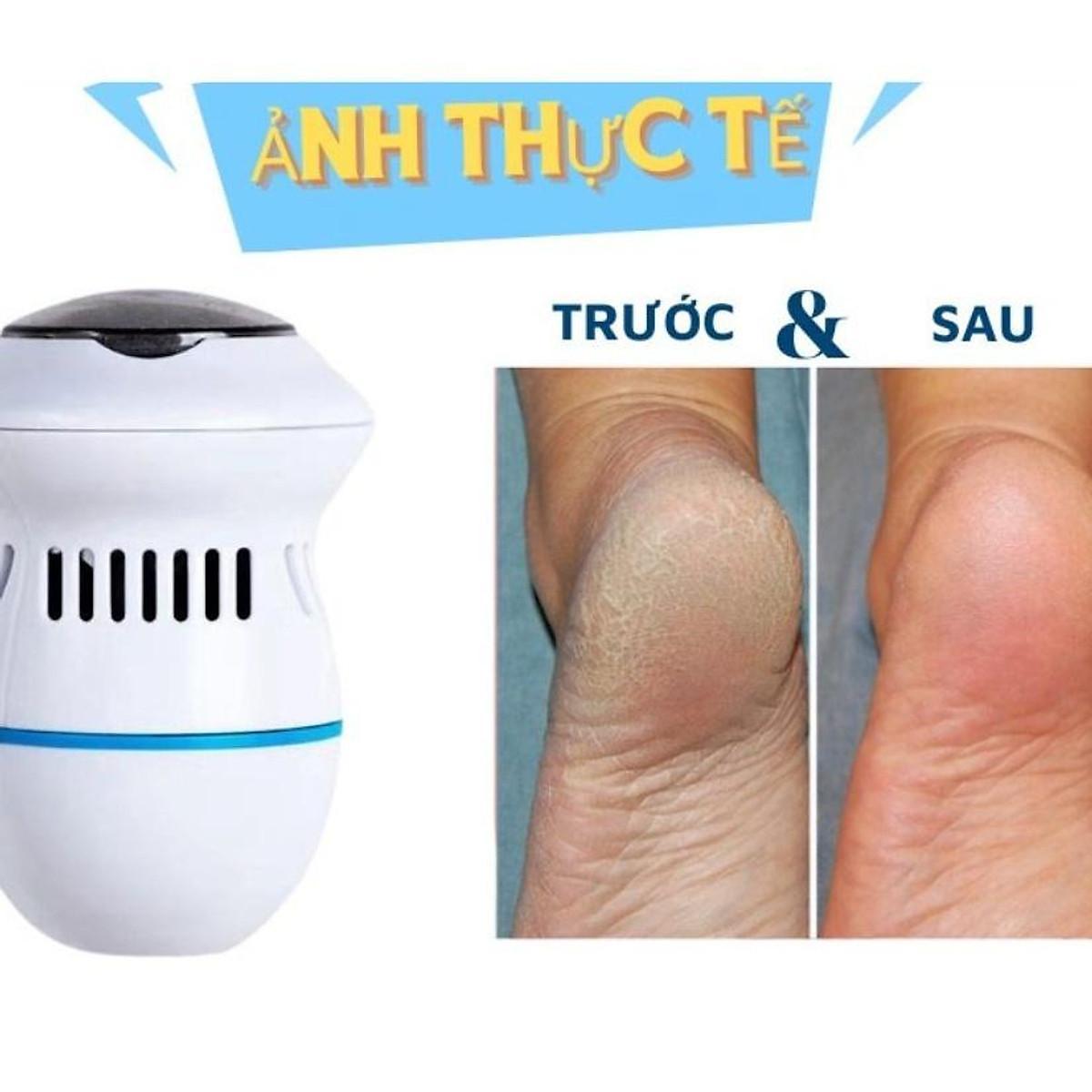 Máy Mài Gót Chân Sạc Điện Cao Cấp Tẩy Tế Bào Chết Làm Mịn Da Cho Tiệm Nail Cá Nhân Tại Nhà Tiện Dụng Máy Chà Gót Chân