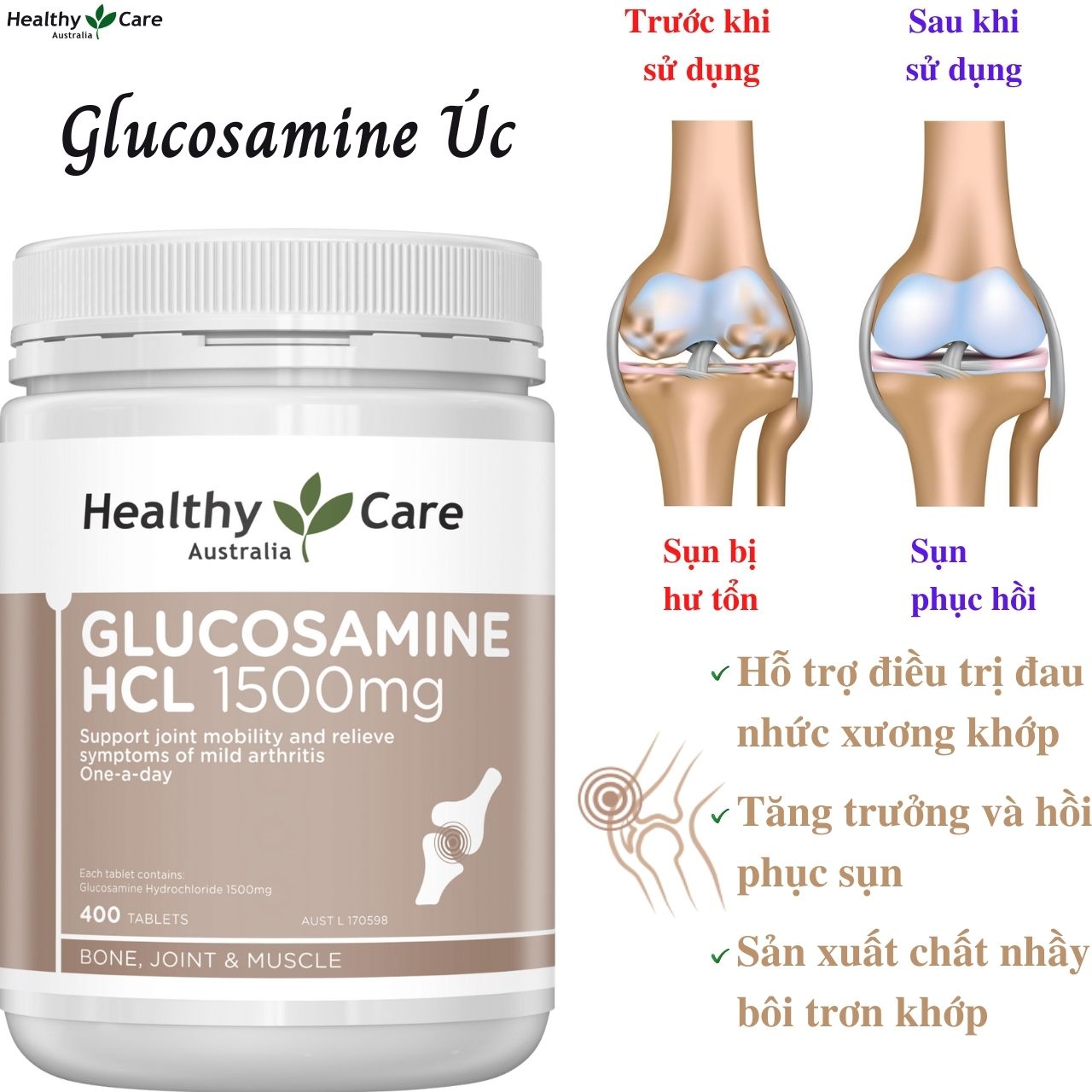 Glucosamine Úc Healthy Care HCL 1500mg Hỗ trợ giảm đau nhức xương khớp, tăng trưởng và hồi phục sụn, sản xuất chất nhầy cho khớp 400V - OZ Slim Store