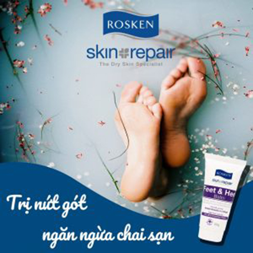 Kem dưỡng tay và chân Rosken Skin Repair Feet Heel Balm 50g - làm mềm vết chai sần, lành vết nứt