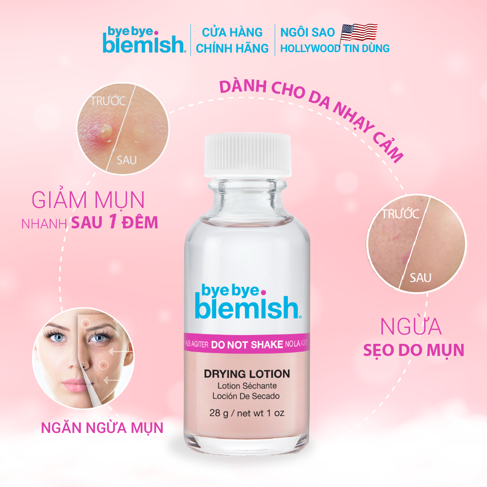 Chấm Mụn Giảm Mụn Nhanh Sau 1 Đêm Dành Cho Mụn Trắng, Sưng Đỏ Bye Bye Blemish Original Drying Lotion 30ml
