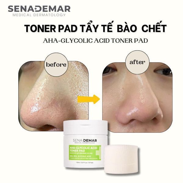 Toner Pad SENADEMAR giúp tẩy tế bào chết giúp da sáng mịn từ Hàn Quốc 150ml/70 miếng hạn 2027