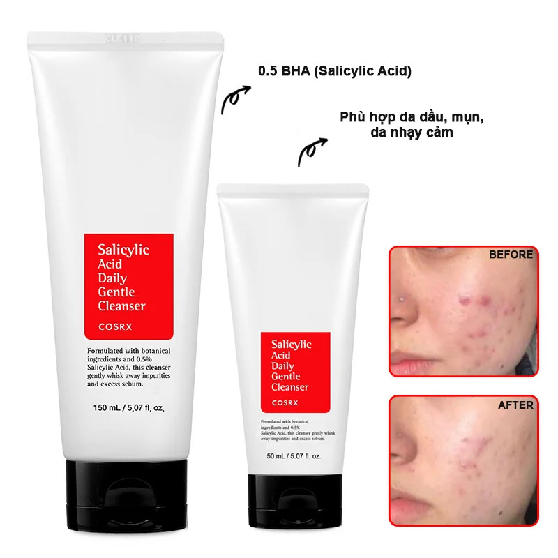 Sữa rửa mặt COSRX Salicylic Axit 0.5% 150ml tái tạo da hiệu quả