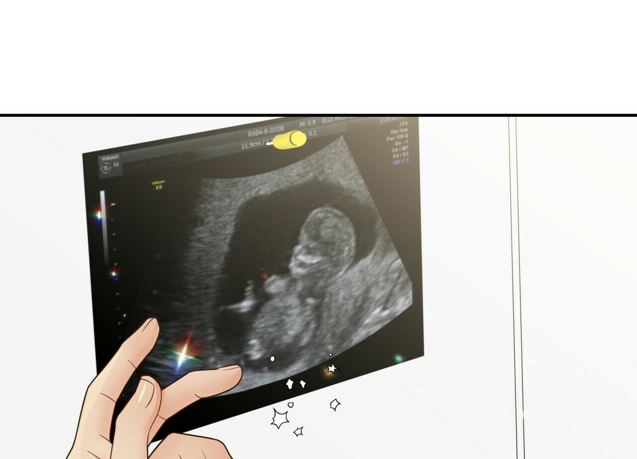 thời gian giữa sói và chó chapter 63 150