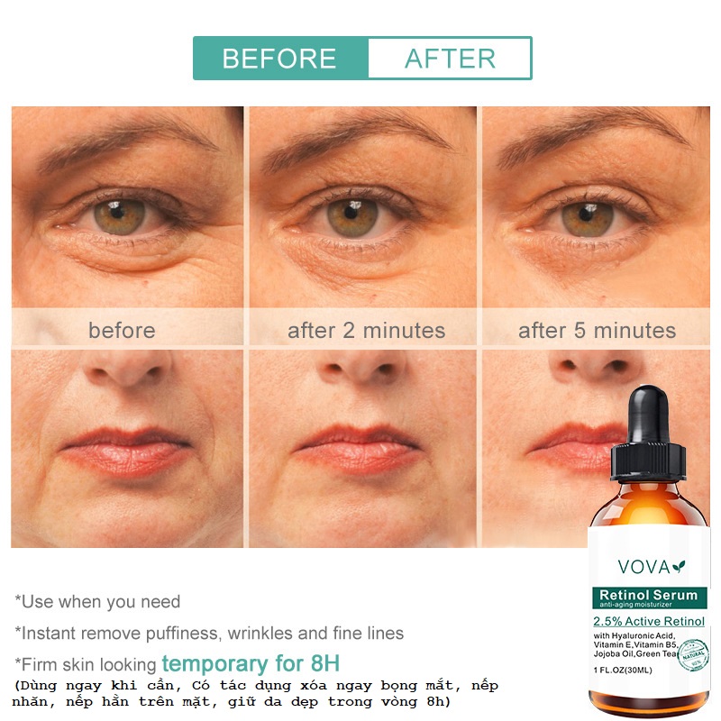 Serum xóa chân chim, nếp nhăn, quầng thâm, bọng mắt, thành phần Vitamin và thảo dược tự nhiên