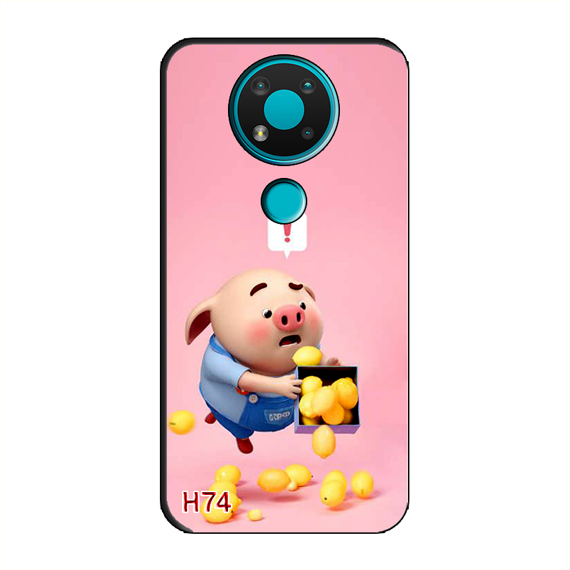 Ốp Dẻo Dành Cho NOKIA 3.4