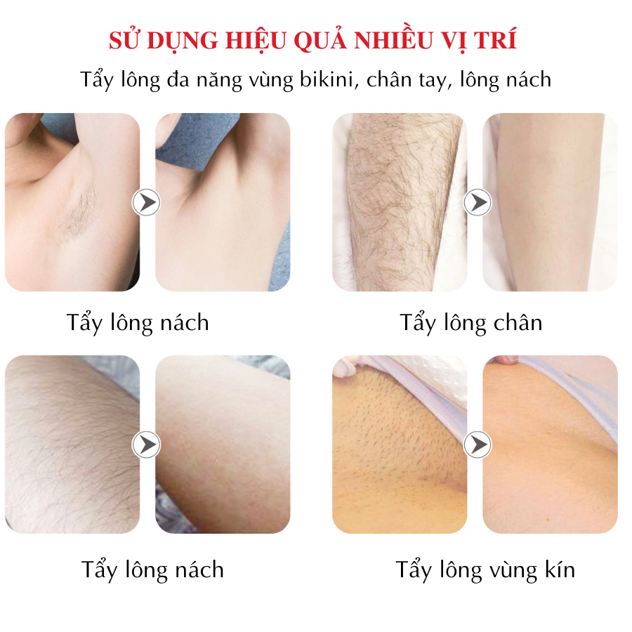 Máy cạo lông đa năng phụ nữ Boorui - Bút triệt phần tay, chân, bikini... thẩm mỹ cho phái đẹp sạc, USB an toàn