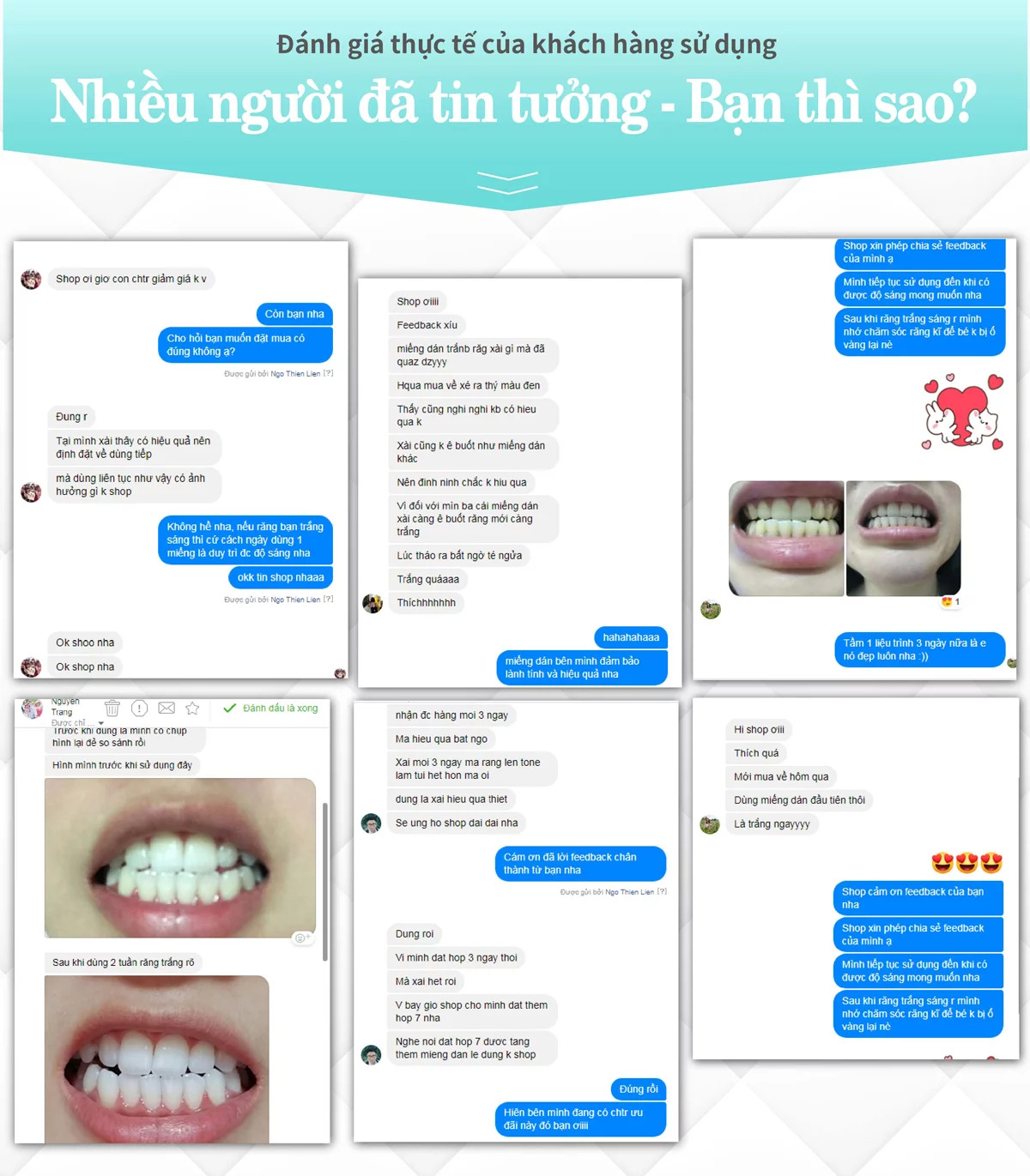 [Liệu Trình 21 Ngày Tặng Liệu Trình 4 Ngày] Miếng Dán Trắng Răng Anriea Black Tooth Whitening