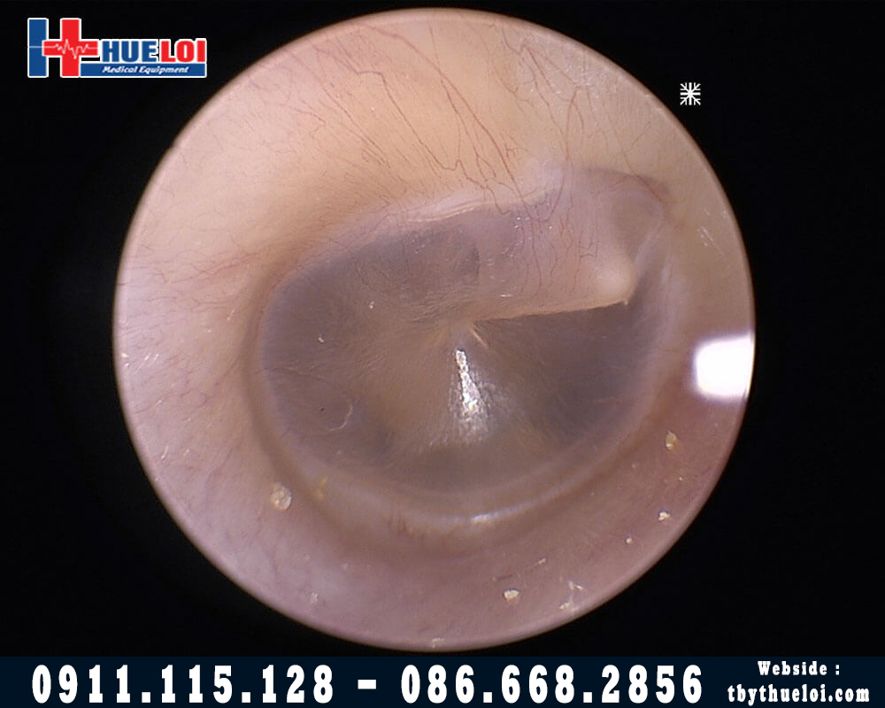 Máy Nội Soi Tai Mũi Họng FULL HD - FHD 180 - Hình Ảnh Sắc Nét Có Kèm Màn Hình Mini 7ich,Kèm 2 optic tùy chọn