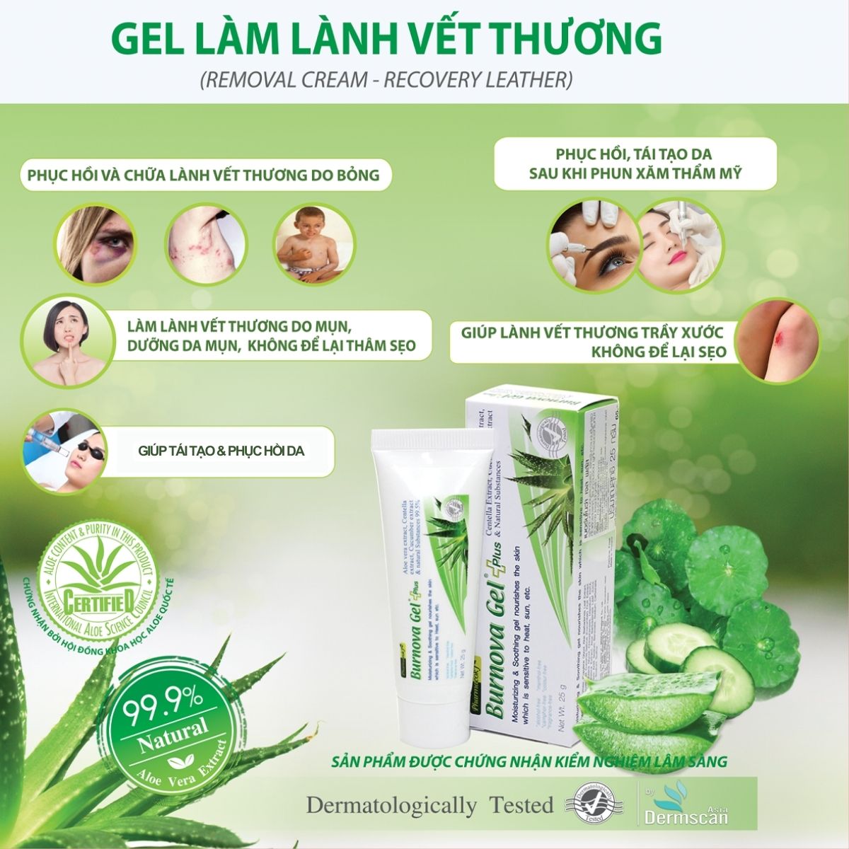 Gel thoa bỏng Burnova Plus tái tạo da sau bỏng, sau laser, làm lành vết thương, vết thương mụn 25g