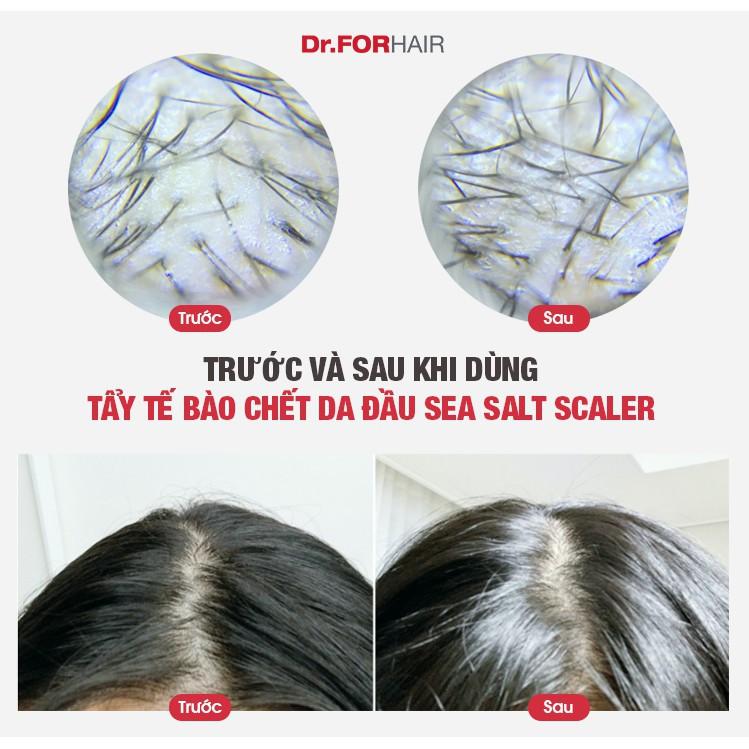 Bộ Dầu Gội Tẩy Tế Bào Chết Dr.FORHAIR/Dr For Hair Sạch Gàu, Giảm Rụng Tóc Và Kích Mọc Tóc