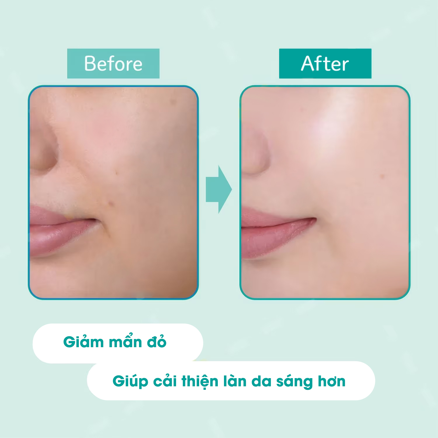 Kem Chống Nắng Nâng Tone Kose Suncut Tone Up Uv Essence Gn Spf50+ Pa++++ 80G ( Màu Xanh Mint )