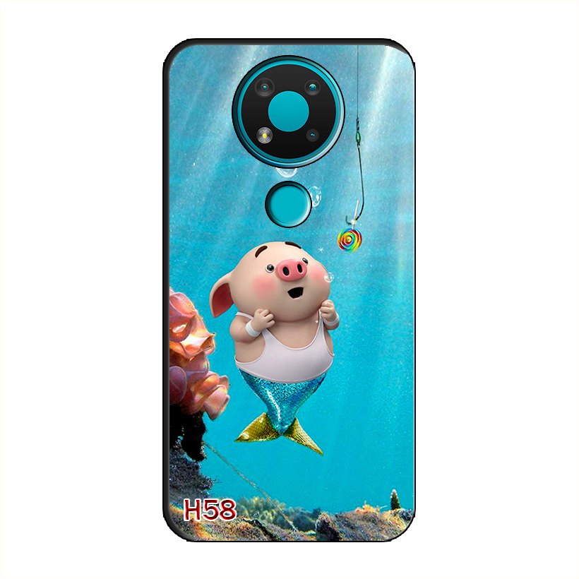 Ốp Dẻo Dành Cho NOKIA 3.4