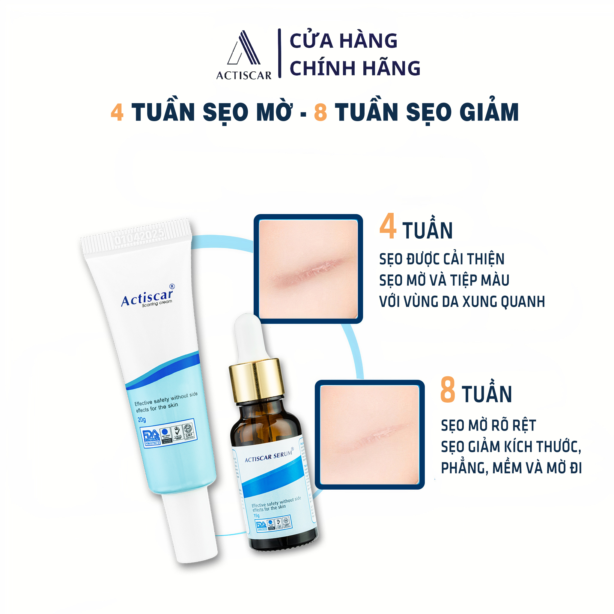 - Hỗ Trợ Trị Sẹo Actiscar làm mờ sẹo Lồi, Sẹo Lõm, Sẹo Rỗ, Sẹo Thâm Lâu Năm