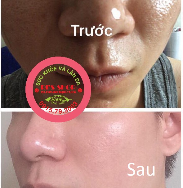 KEM FACE BAMBOO - DƯỠNG DA TRẮNG HỒNG - ĐẨY LÙI NÁM, TÀN NHANG, CHỐNG NẮNG - NHANH CHÓNG PHỤC HỒI DA HƯ TỔN