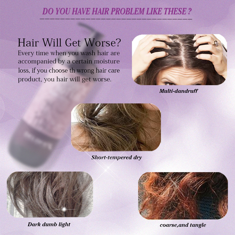 Dầu gội mềm mượt Hỗ Trợ Điều Trị Gàu Delofil