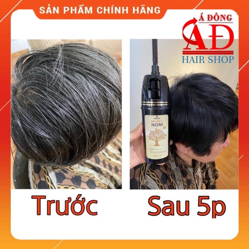 DẦU GỘI PHỦ BẠC NONI VISIAMI KÈM LƯỢC ĐEN TÓC TRONG 5 PHÚT 200ML