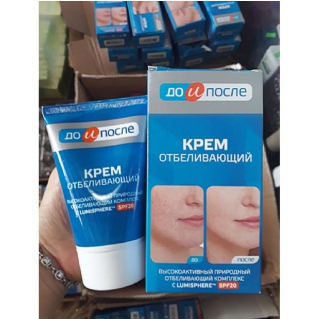 Kem xóa nám Kpem Nga - Kem loại bỏ nám trắng da Nga Kpem