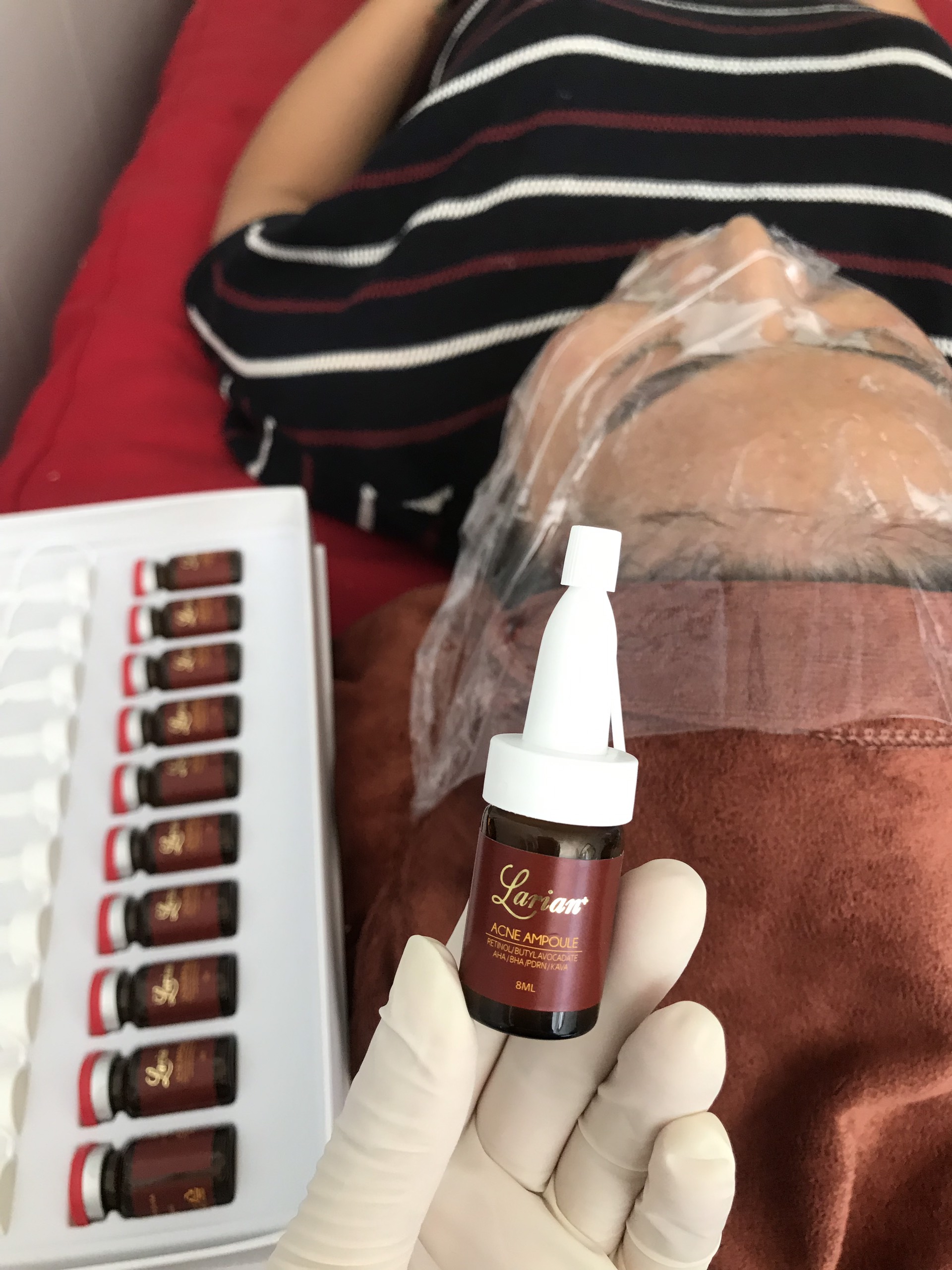 Tế bào gốc trị mụn Dna Cá Hồi Larian Acne Ampoupe dành cho Spa trong liệu trình trị liệu chuyên sâu cho da mụn