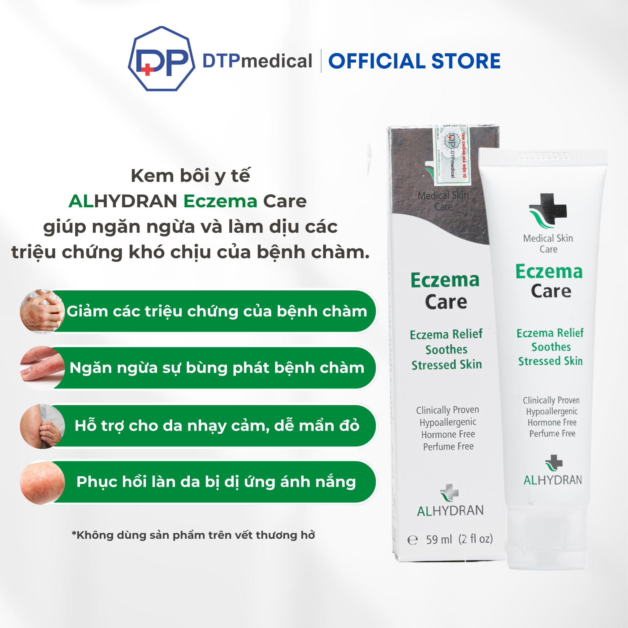 Kem bôi y tế ALHYDRAN Eczema Care 59ml làm giảm triệu chứng bệnh chàm, giảm ngứa, mẩn đỏ và cảm giác nóng rát