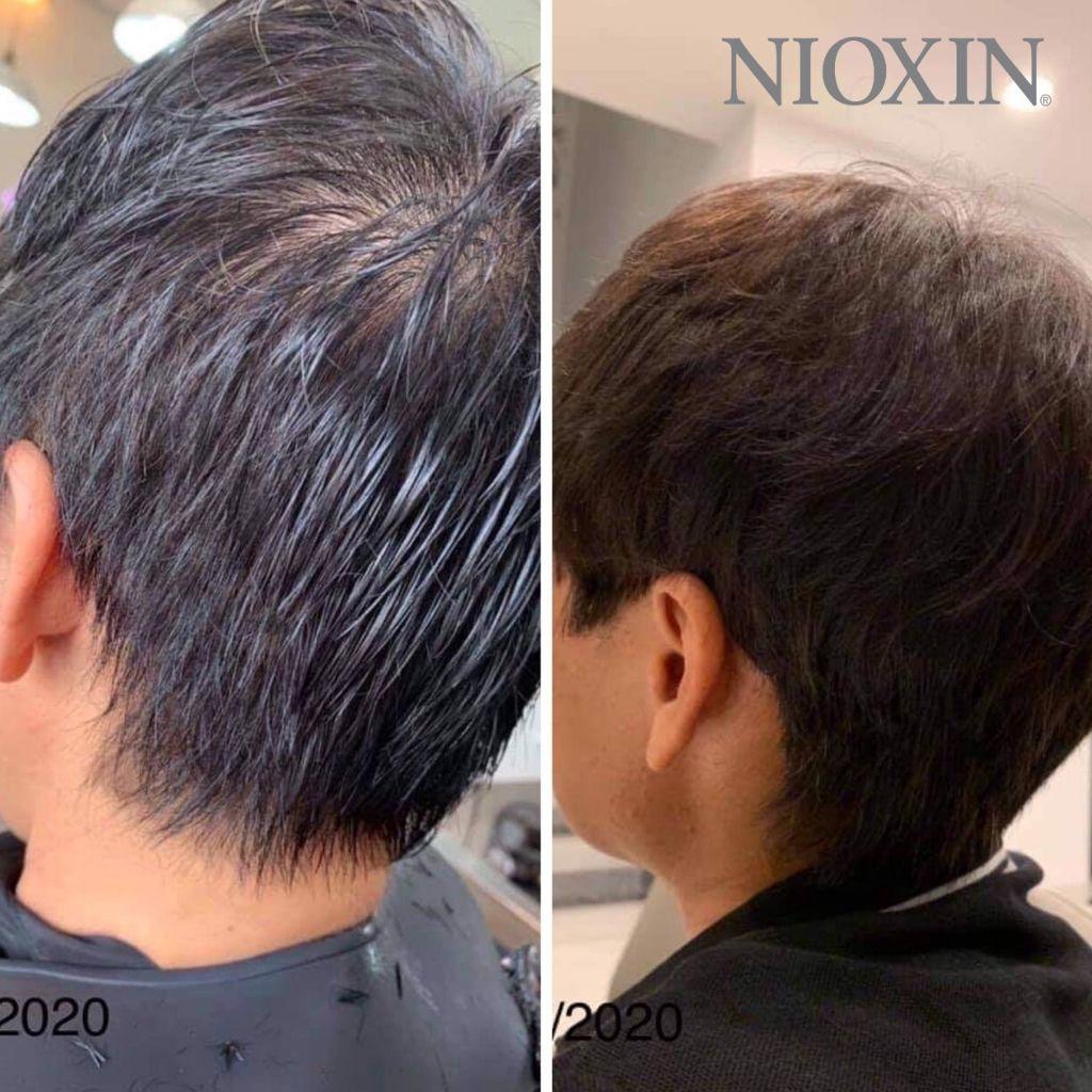 Bộ Chăm Sóc Tóc Nioxin 2 Dành Cho Tóc Tự Nhiên, Thưa Mỏng Và Rụng Nhiều Natural Hair With Progressed Thinning