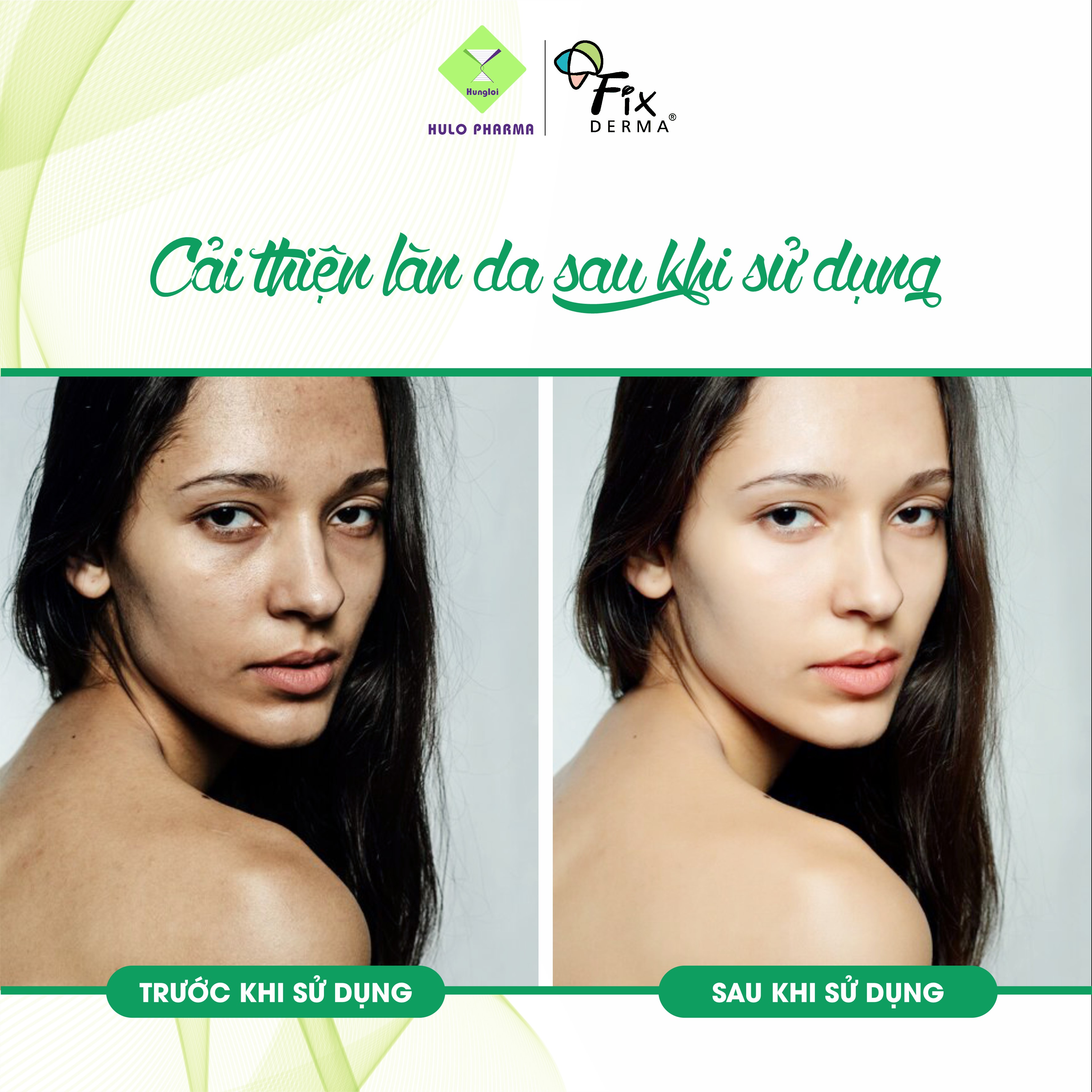 Kem dưỡng da FIXDERMA Cleovera Cream (60g)