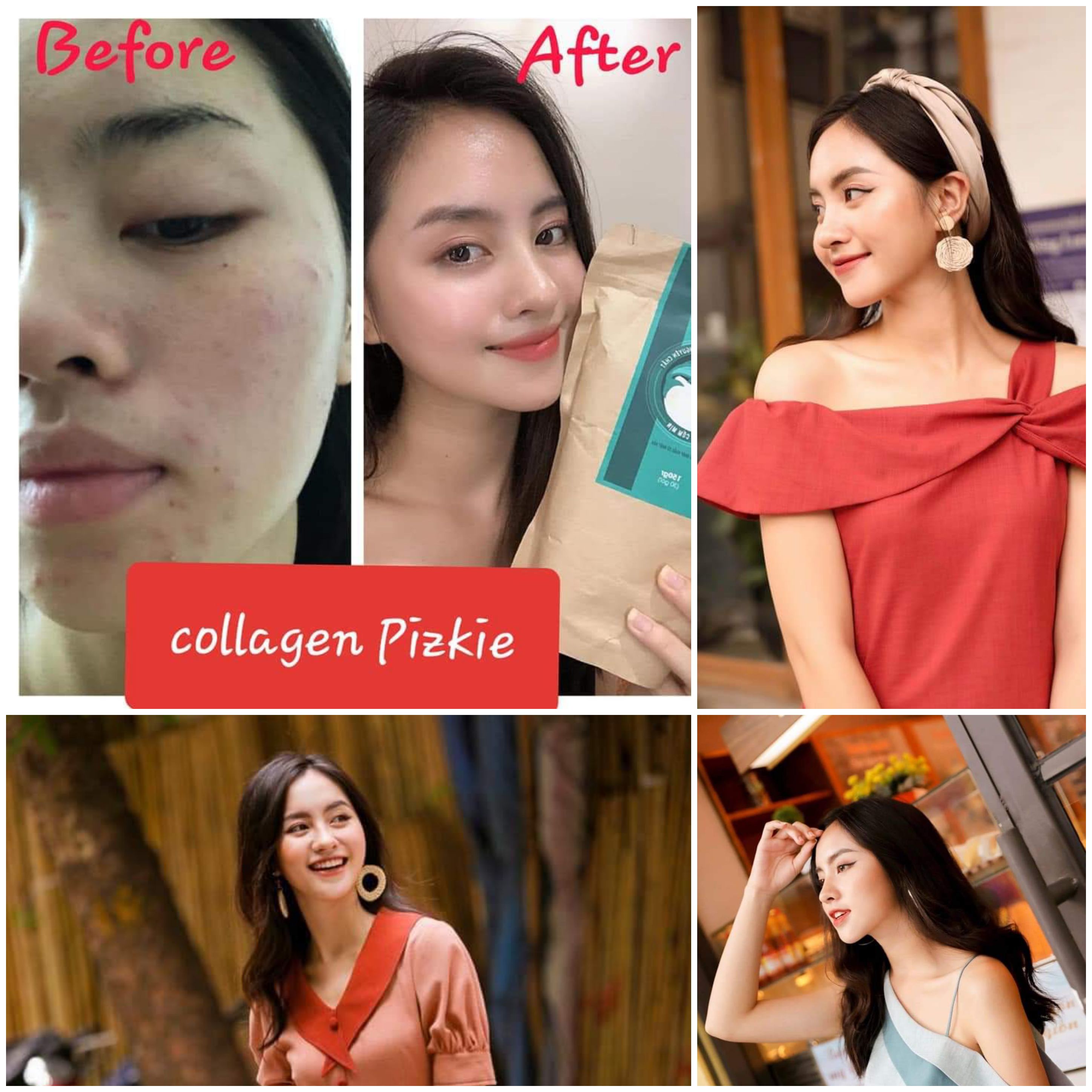 [MUA 3 TẶNG 1] COMBO 3 GÓI COLLAGEN PEPTIDE PIZKIE CÁ HỒI NHẬT BẢN - GIÚP LÀM ĐẸP DA, HỖ TRỢ LÀM MỜ ĐỐM NÂU, TÀN NHANG, TĂNG CƯỜNG ĐỘ ĐÀN HỒI  VÀ CUNG CẤP ĐỘ ẨM CHO LÀNDA 