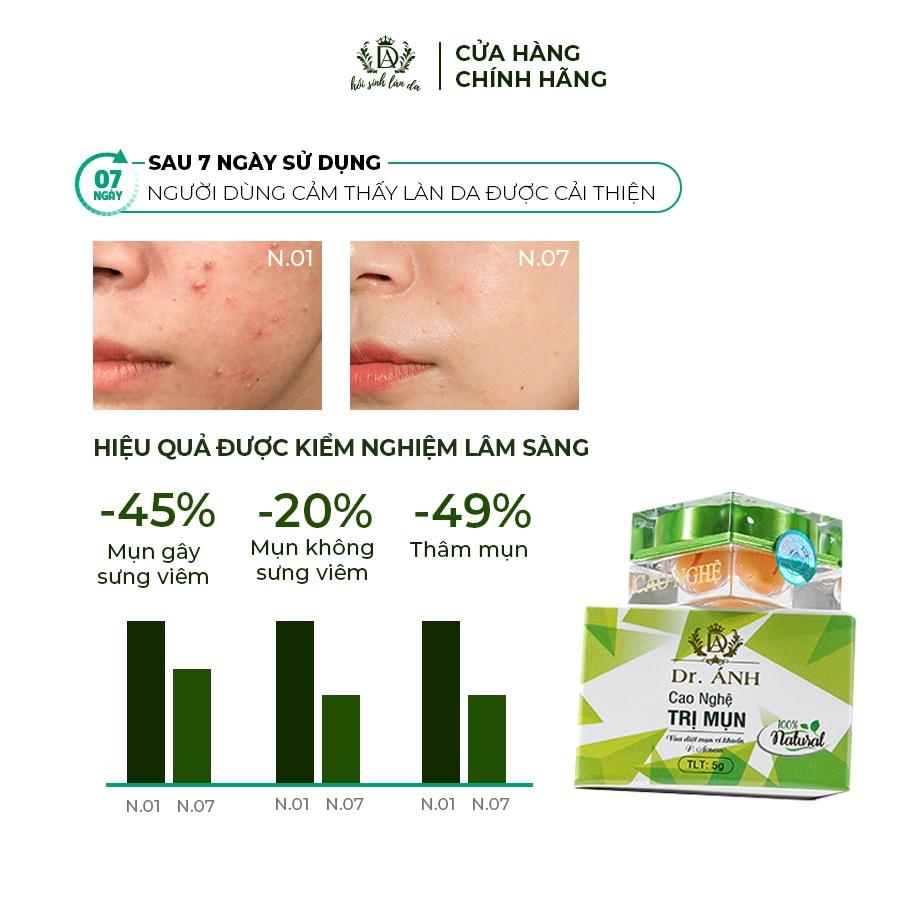 Combo 3 hộp Cao nghệ giảm mụn Dr. ánh Hồi sinh làn da