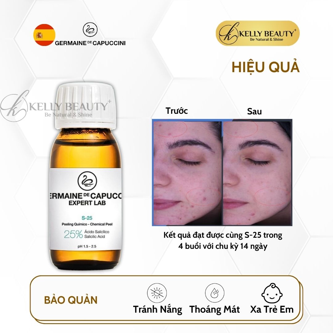 Dung Dịch Peel Da Dầu Mụn Germaine Expert Lab Salicylic 25% Chemical Peel S-25 | Kelly Beauty