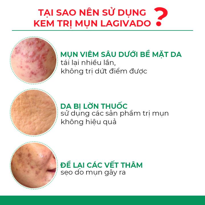 Kem chấm giảm mụn Hàn Quốc Lagivado ngừa thâm sẹo rỗ, thông thoáng lỗ chân lông Dr. Atreat Cream 30 ml