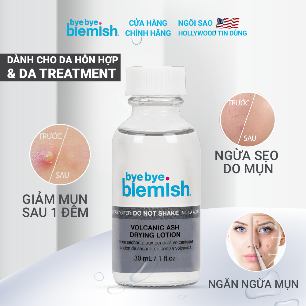 Chấm Mụn Tro Núi Lửa Giảm Mụn Nhanh Sau 1 Đêm Dành Cho Mụn Trắng, Sưng Đỏ Bye Bye Blemish Volcanic Ash Drying Lot