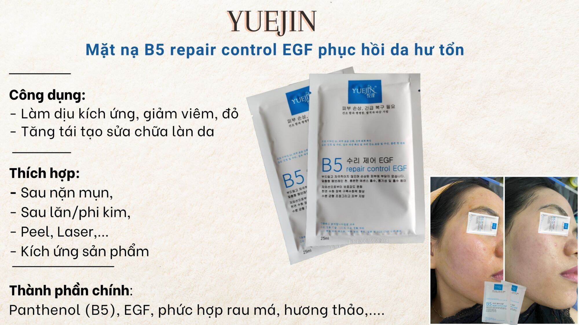 Mặt nạ phục hồi cấp ẩm Yuejin B5 Repair Control EGF Mask ( 1 miếng )