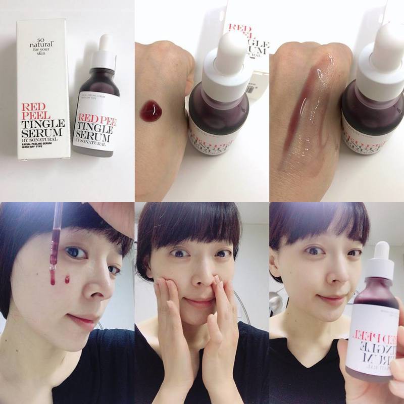 [Mẫu mới 2020] Tinh Chất Tái Tạo và Phục Hồi Da Red Peel Tingle Serum 35ml - Tặng Kèm Cột Tóc Nơ BERAV Handmade Annie Ribbon Giao Màu Ngẫu Nhiên