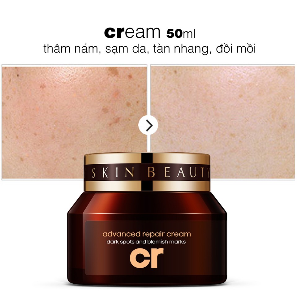 Cream Thâm Nám, Sạm Da, Tàn Nhang, Đồi Mồi 50ml cho Nam TẶNG Gel Vệ Sinh Vùng Kín Nam 100ml LANGCE