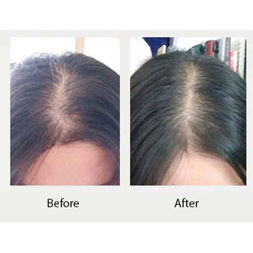 Huyết thanh kích mọc và làm dày tóc Weilaiya Ginger Hair Root Nourishing Essence