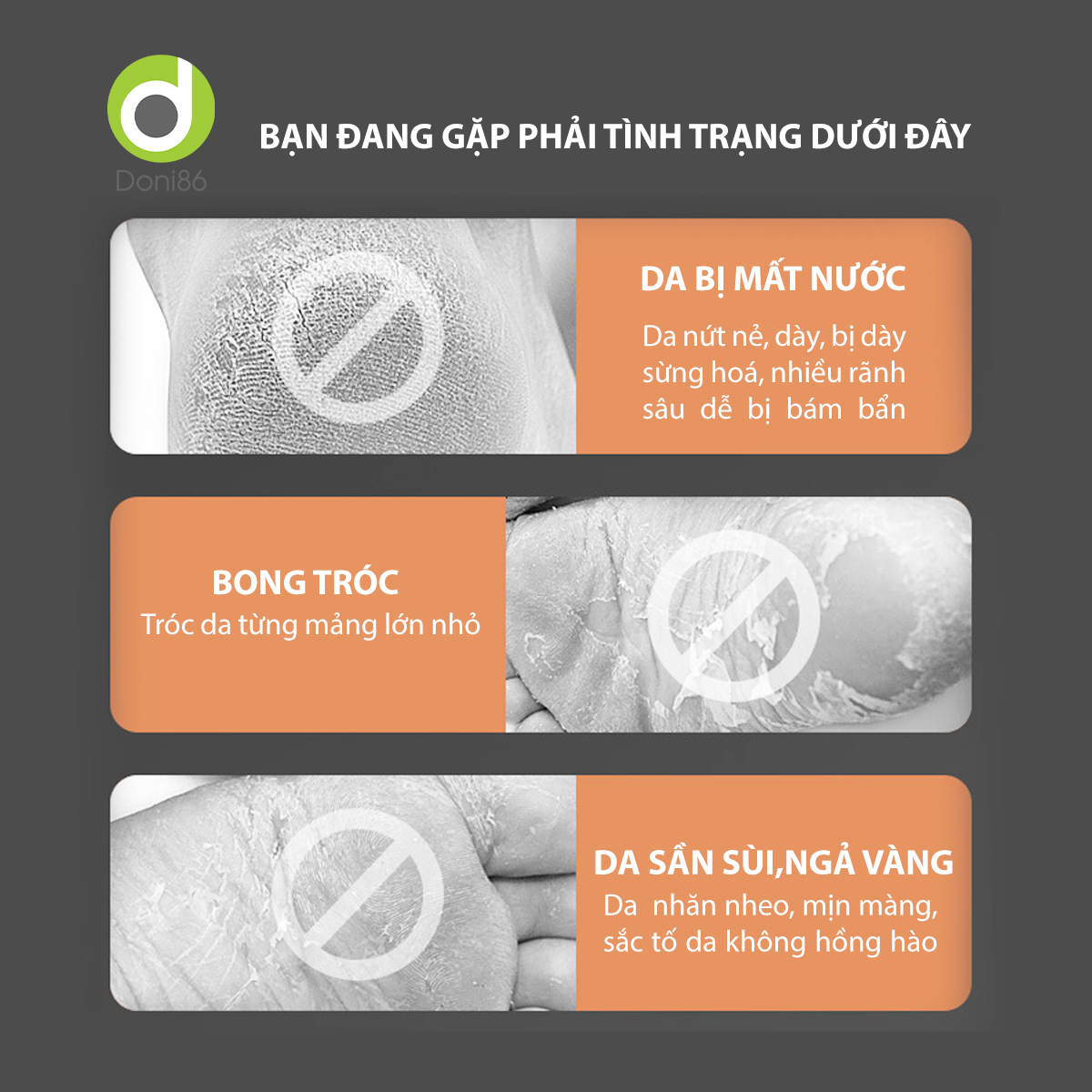 Vớ bọc gót chân silicone chống nứt nẻ chống bong tróc da, bảo vệ gót - Doni - DOPK68