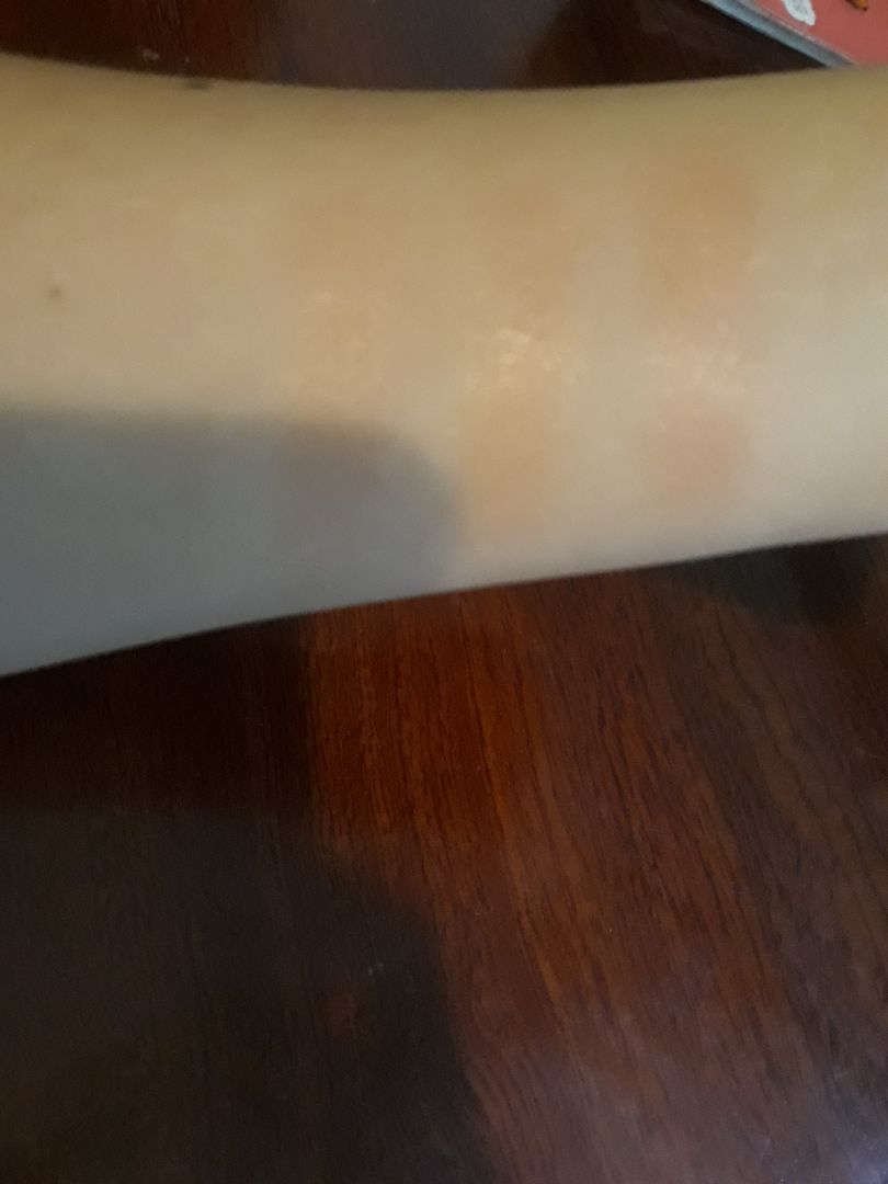 Đầu  tiên về phần vỏ rất chắc chắn k thể trừ điểm được. Nhưng  điều mình quan tâm nhất về chất lượng thì em này làm mình không hài lòng. Mùi rất kì, mình ngửi như mùi đất sét. Bôi nhiều lớp lên sẽ ra màu hồng cánh sen rất dìm(nếu không tẩy da chết). Chất son giống son gió nhưng chậm hơn.để tầm 1-2h môi bắt đầu hồng choét lên trông rất sợ. Hình ảnh dưới đây là môi mình sau khi tẩy da chết và bôi lớp mỏng lên( trông không quá đáng sợ nhưng 1 tgian sau lên màu k đc đẹp) nếu như muốn mua thì bạn chỉ nên bôi ở nhà nếu không sẽ k kiểm soát đc màu son. Son này rất lì luôn ấy. Trời càng lạnh nó lên màu càng nhanh. màu mình mua là cam san hô. Hi vọng nếu như cải thiện màu son này nhà sx sẽ cho thêm nhiều đỏ hơn là hồng