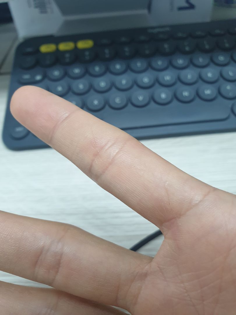 Phần sống dao quá bén. Bữa nào mà quên để ý, ấn mạnh xuống là tay bị đứt, mình không biết phải làm sao. xài hơn 1 tháng mà tay mình đứt 3 4 lần.