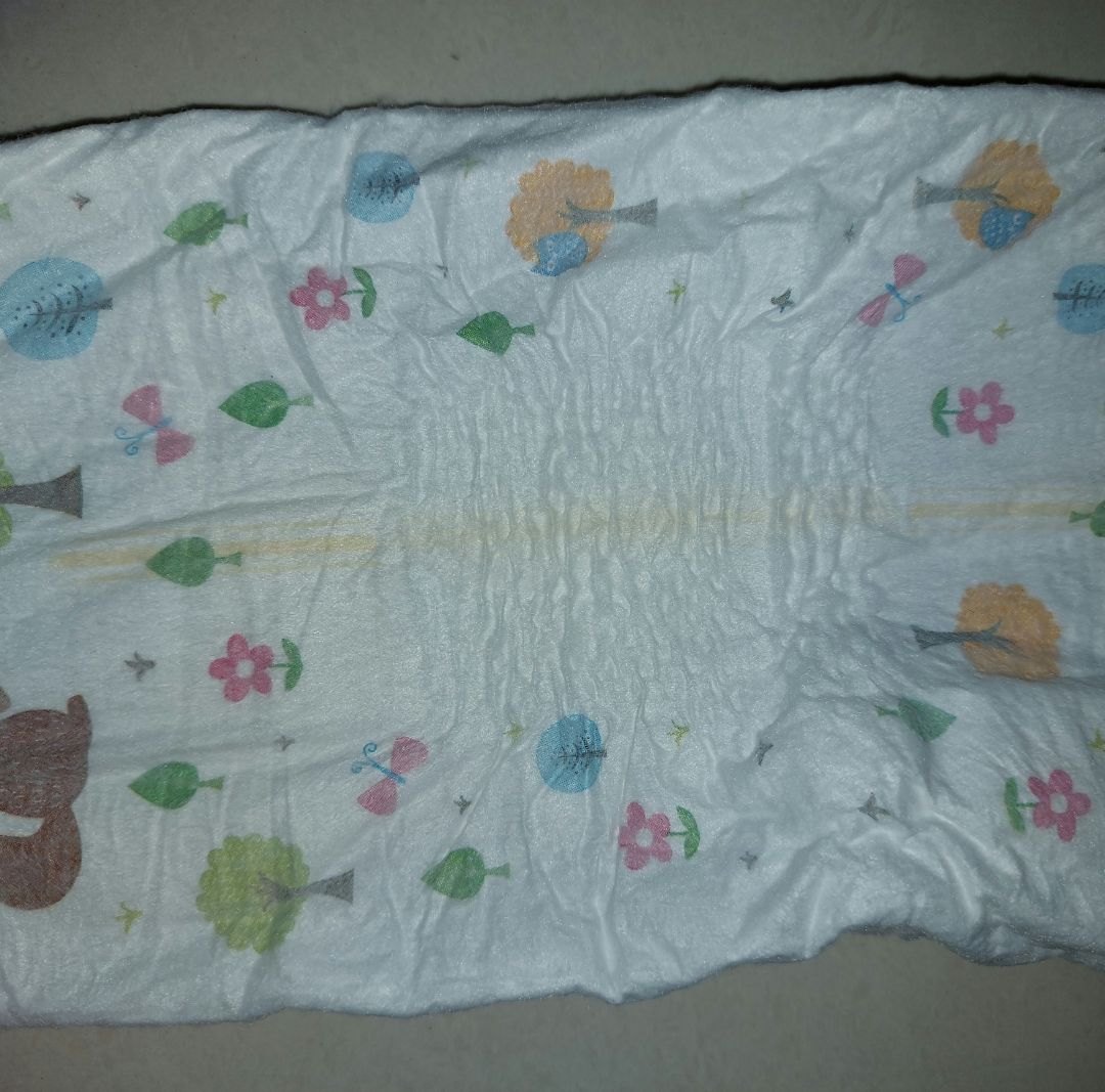 tã bị lỗi, nhăn 1 mảng giữa tã, phần nhăn khá cứng, mình đang đề nghị đổi trả hàng. mong là được đổi/trả chứ mùa dịch đã thất nghiệp mà con dùng tã khác bị hăm nên ráng mua loại mắc chút sài, thấy rẻ hơn mua mấy cửa hàng mẹ và bé nên mua thử mà xui vậy.