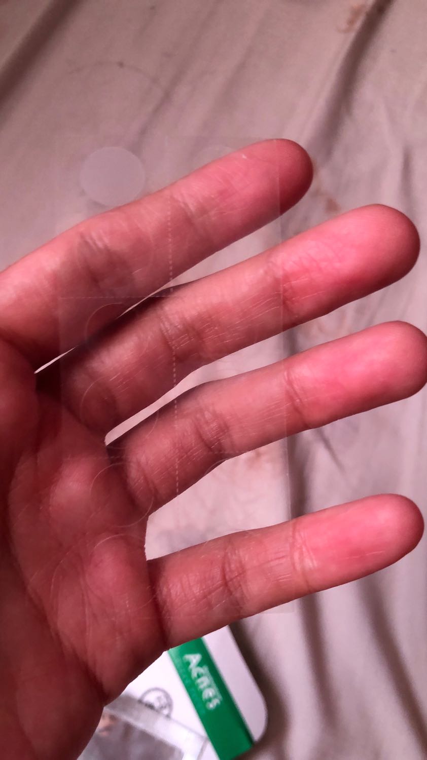 Hiệu quả hút mụn không bằng Mayan Care dù đắt gấp đôi. Chỉ được mỗi cái miếng dán siêu mỏng (mỏng gấp đôi Mayan), nên nếu ai dùng với mục đích bảo vệ mụn để trang điểm thì ok, còn để hút cồi mụn thì không nên vì nó chẳng có tác dụng gì mấy. Tiếc là ko chụp khi gỡ miếng dán khỏi mụn (chỉ dính được rất rất ít dịch mụn rỉ ra, không nhiều và hiệu quả bằng Mayan care dù dùng cùng một nốt mụn)