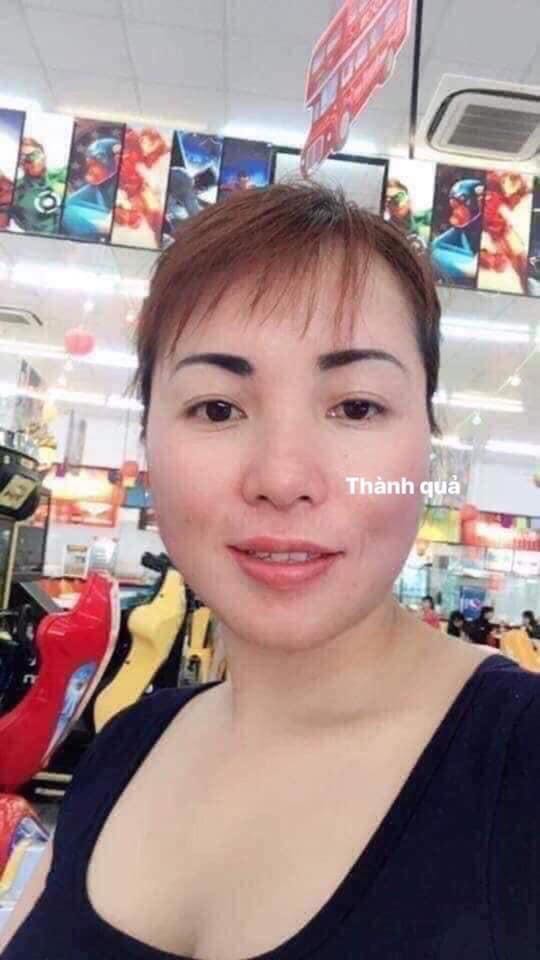 sorry shop nhé. hình ảnh không liên quan. Anh chị em nào bị mụn, nám, sạm, da xấu xí mà chưa tìm dc cách điều trị hiệu quả thì liên hệ em nhé
☎️ *** Zalo, fb 
- Đảm bảo hết mụn 100%, không hết mụn hoàn tiền.